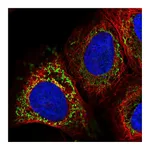 Atlas Antibodies Anti-PAPSS2 Antibody
