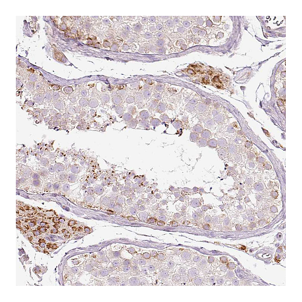 Atlas Antibodies Anti-PAQR9 Antibody
