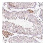 Atlas Antibodies Anti-PAQR9 Antibody