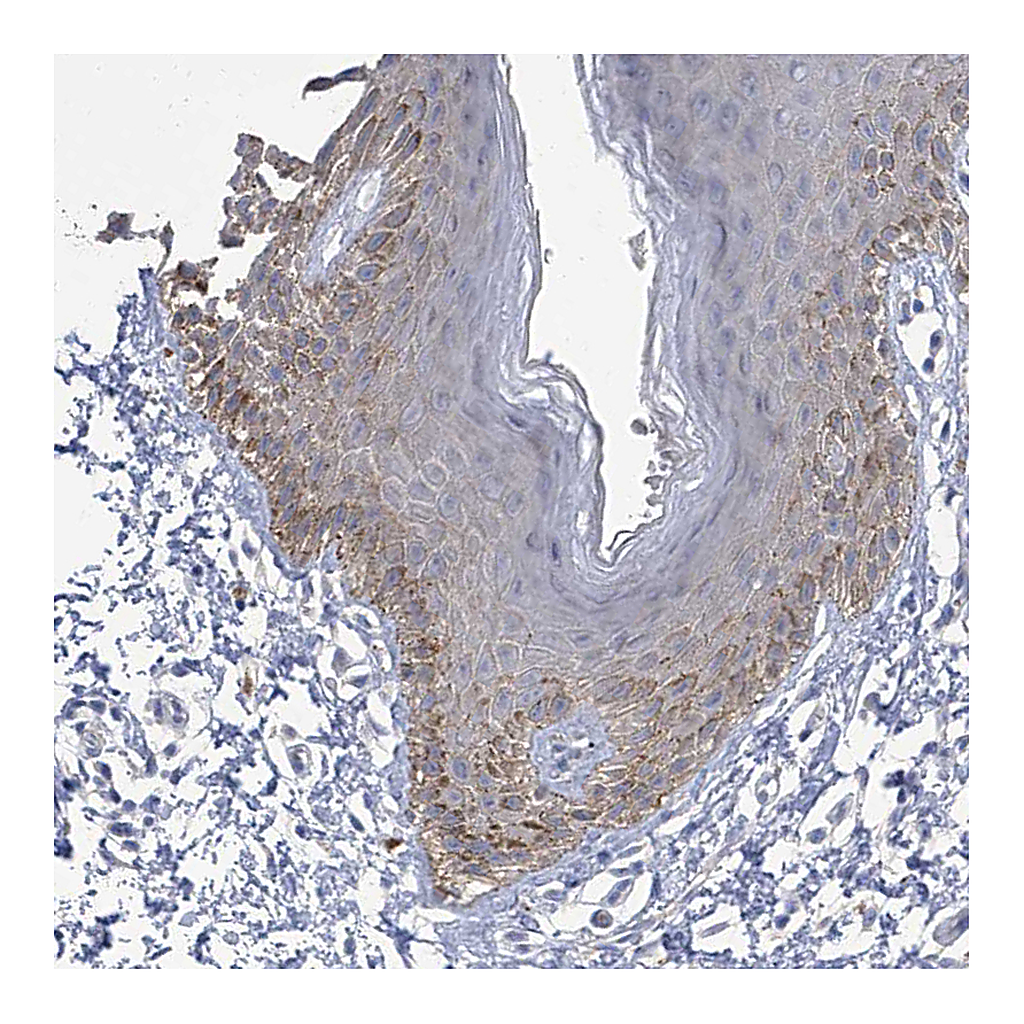 Atlas Antibodies Anti-PARD3 Antibody