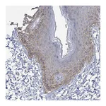 Atlas Antibodies Anti-PARD3 Antibody