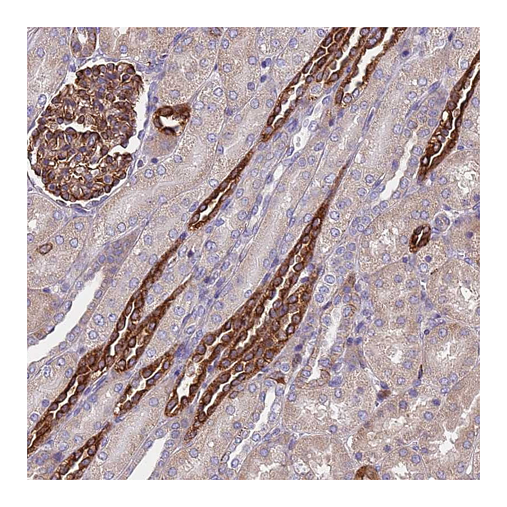 Atlas Antibodies Anti-PAQR7 Antibody