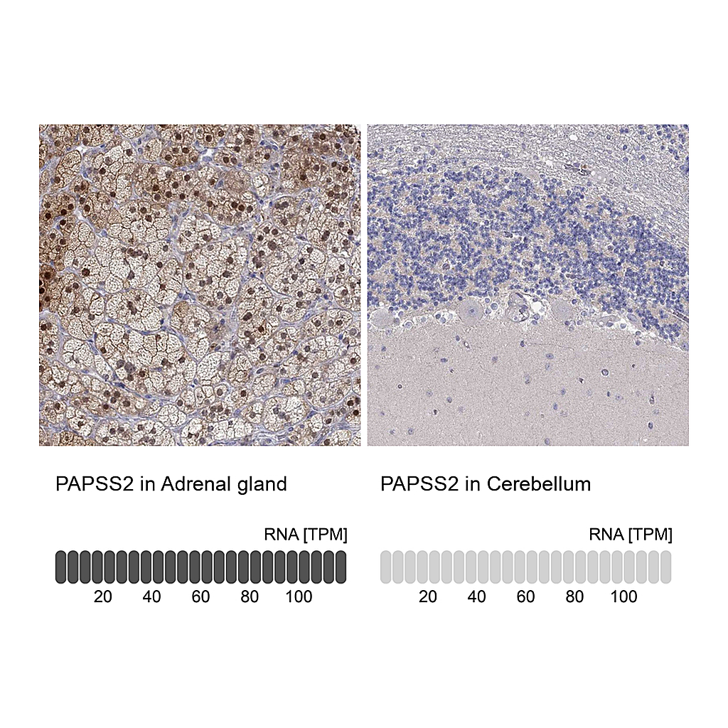 Atlas Antibodies Anti-PAPSS2 Antibody