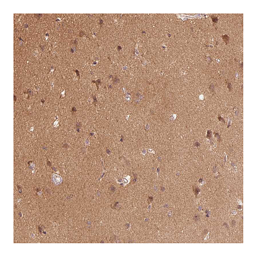 Atlas Antibodies Anti-PARK2 Antibody