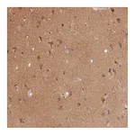 Atlas Antibodies Anti-PARK2 Antibody