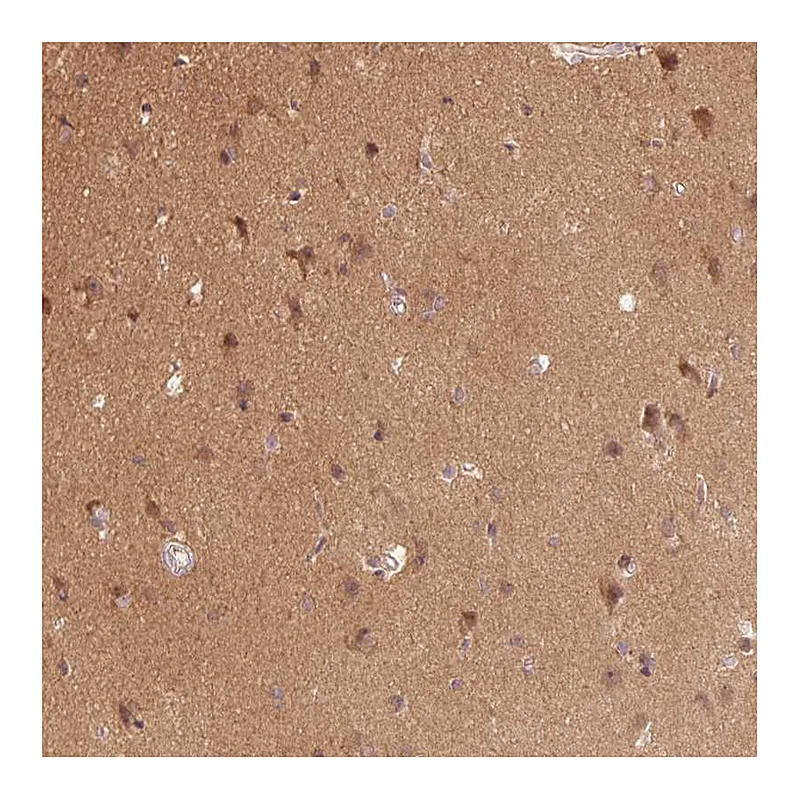 Atlas Antibodies Anti-PARK2 Antibody