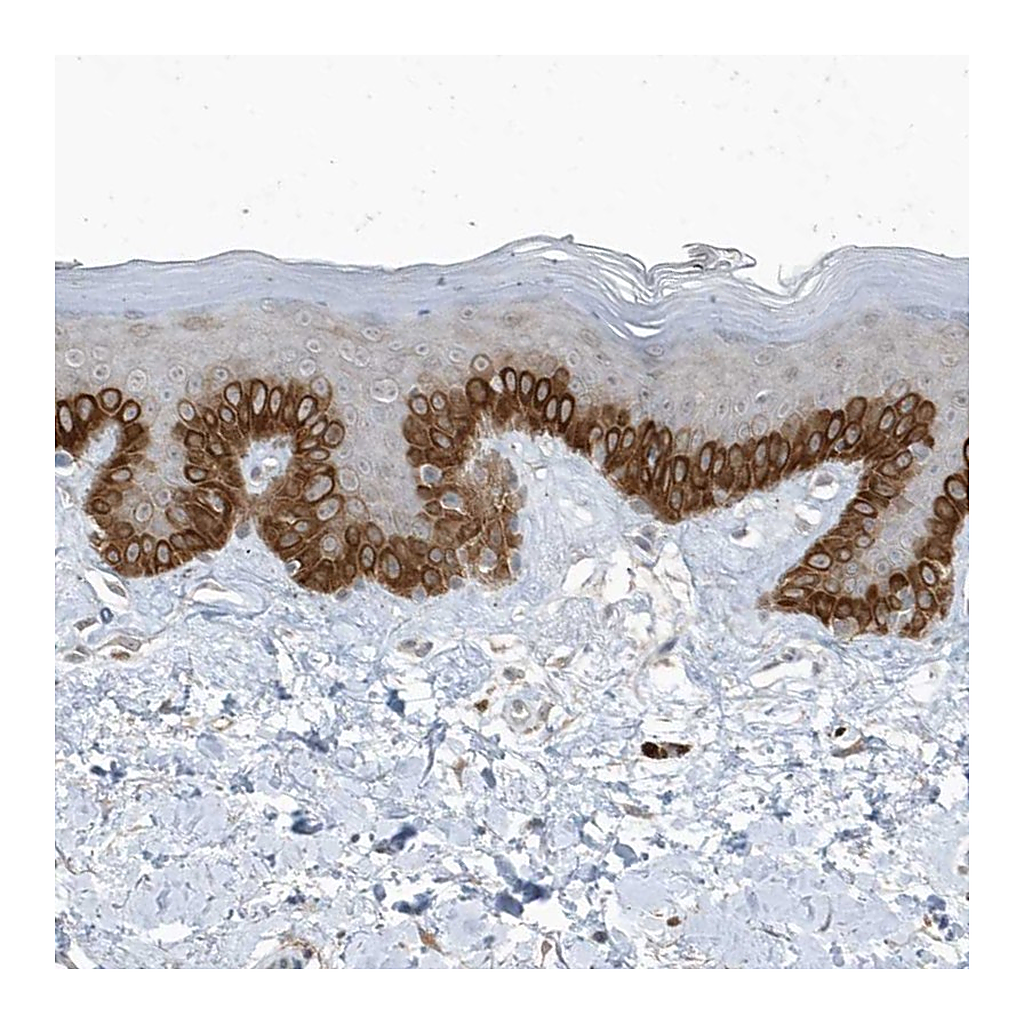Atlas Antibodies Anti-PARD3B Antibody