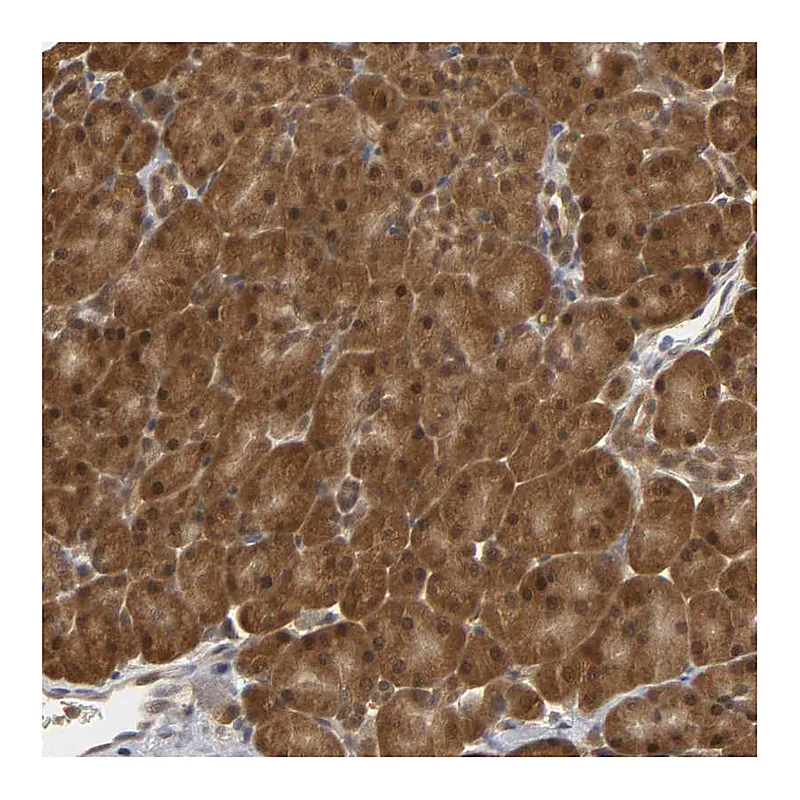 Atlas Antibodies Anti-PARK7 Antibody
