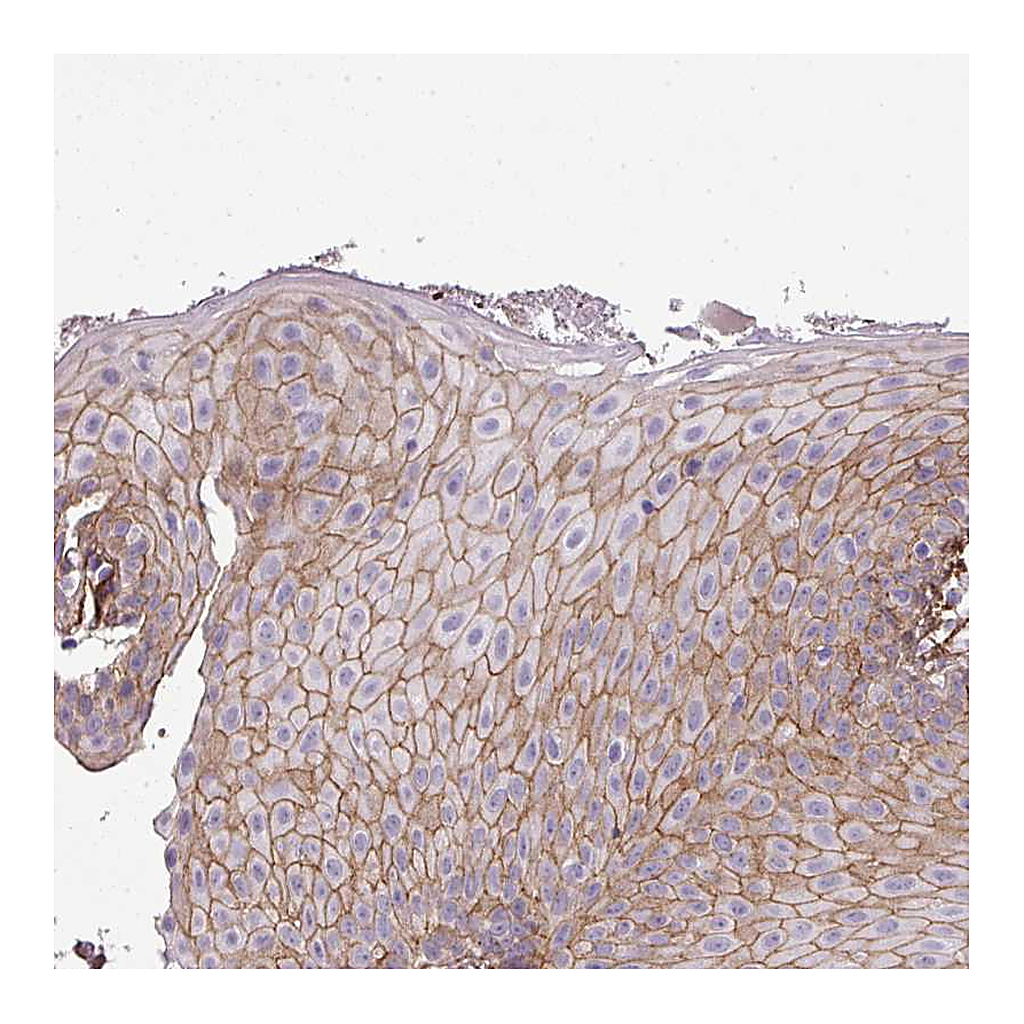 Atlas Antibodies Anti-PARD6G Antibody