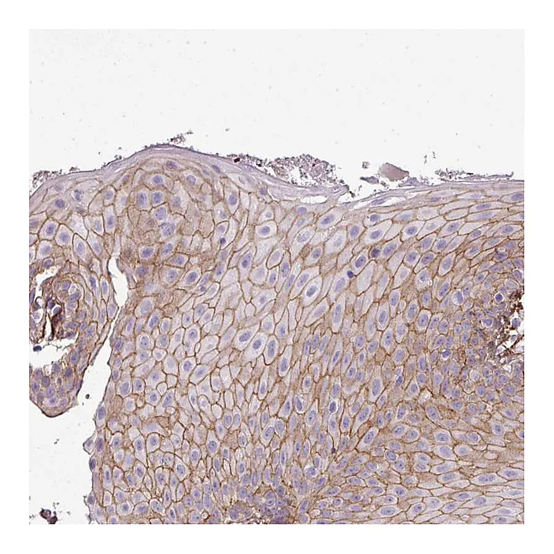 Atlas Antibodies Anti-PARD6G Antibody