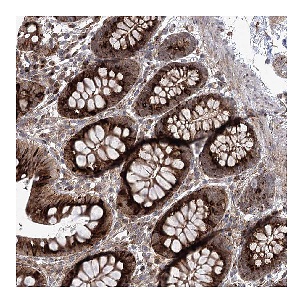 Atlas Antibodies Anti-PARM1 Antibody