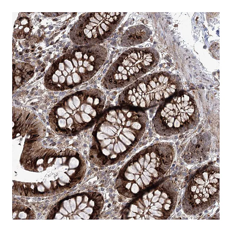 Atlas Antibodies Anti-PARM1 Antibody