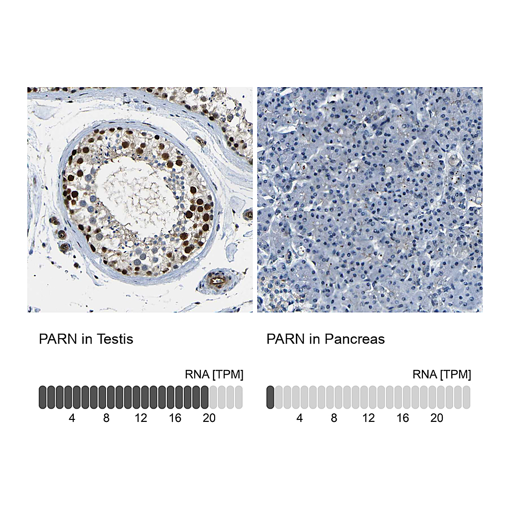 Atlas Antibodies Anti-PARN Antibody