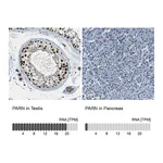Atlas Antibodies Anti-PARN Antibody