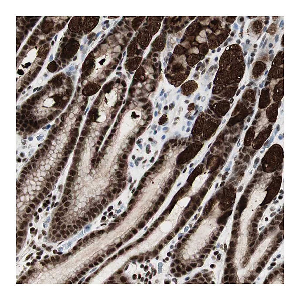 Atlas Antibodies Anti-PARN Antibody