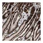 Atlas Antibodies Anti-PARN Antibody