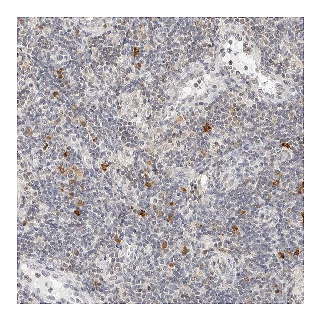 Atlas Antibodies Anti-PARP10 Antibody