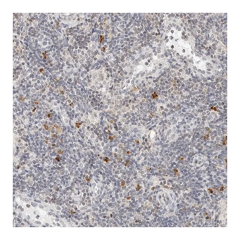 Atlas Antibodies Anti-PARP10 Antibody
