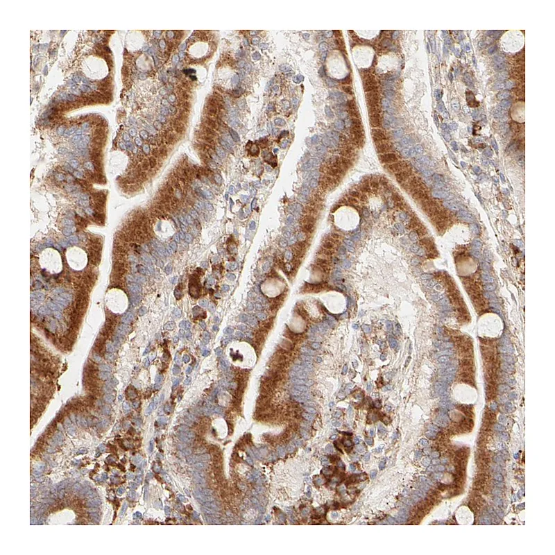 Atlas Antibodies Anti-PARP12 Antibody