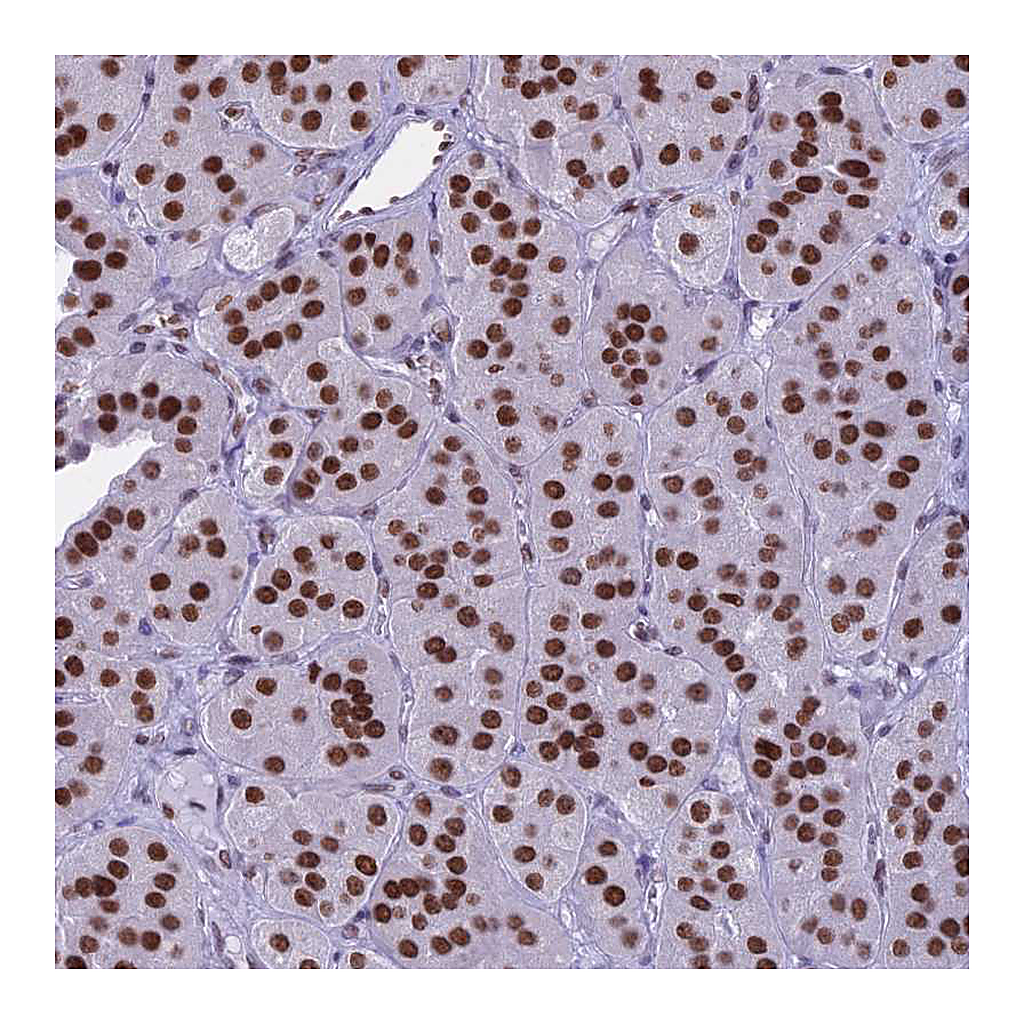 Atlas Antibodies Anti-PARP1 Antibody