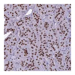 Atlas Antibodies Anti-PARP1 Antibody