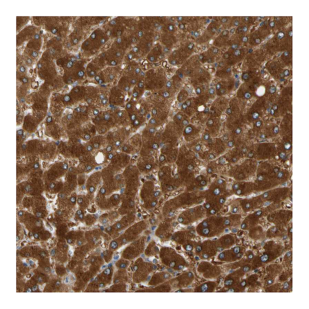 Atlas Antibodies Anti-PARP14 Antibody