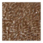 Atlas Antibodies Anti-PARP14 Antibody