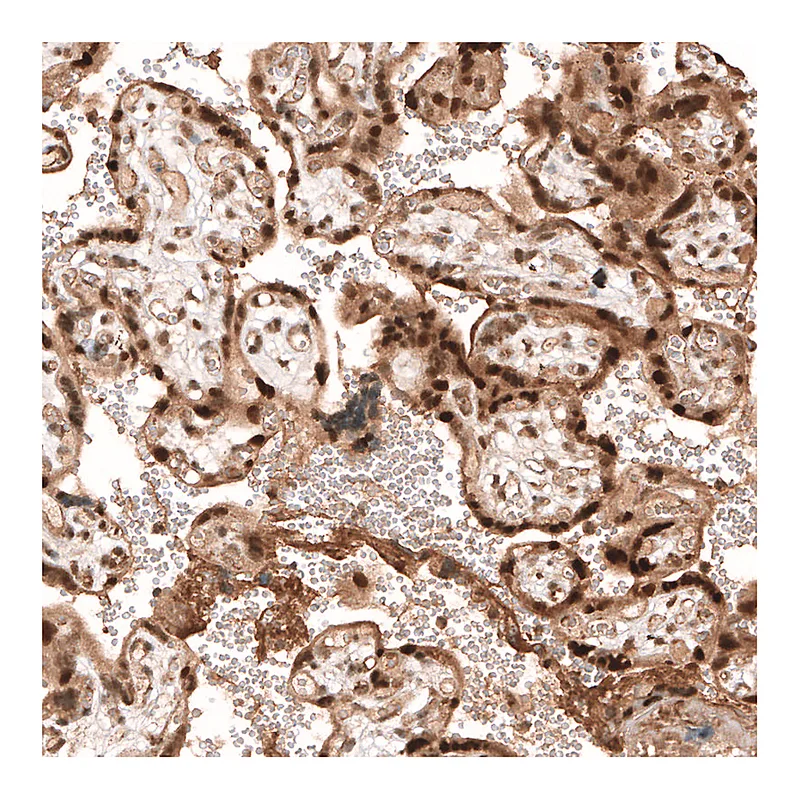 Atlas Antibodies Anti-PARP14 Antibody
