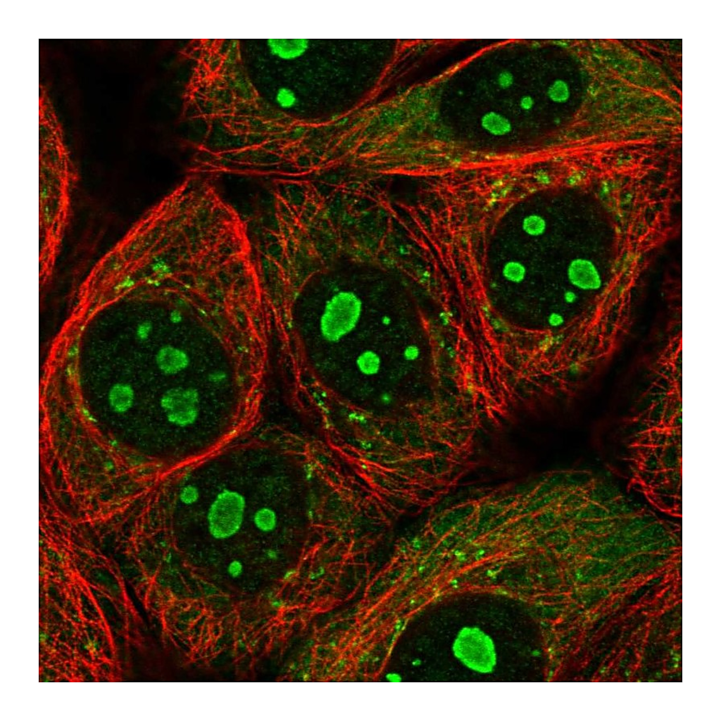 Atlas Antibodies Anti-PARP10 Antibody