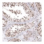 Atlas Antibodies Anti-PARP2 Antibody
