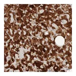 Atlas Antibodies Anti-PARP4 Antibody