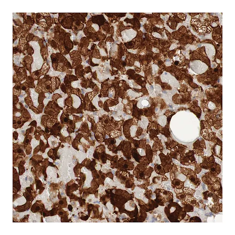 Atlas Antibodies Anti-PARP4 Antibody