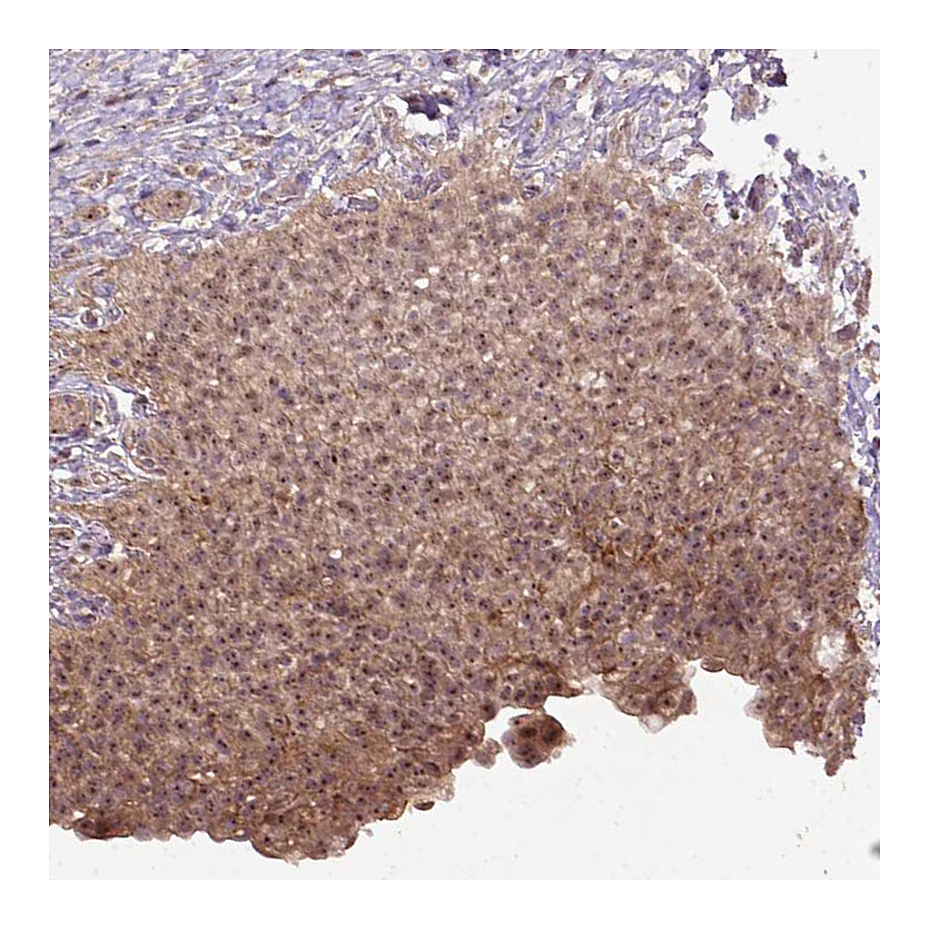 Atlas Antibodies Anti-PARP3 Antibody
