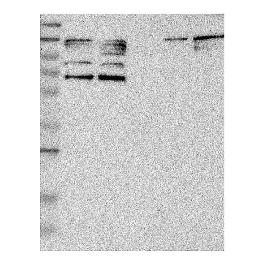 Atlas Antibodies Anti-PARP3 Antibody