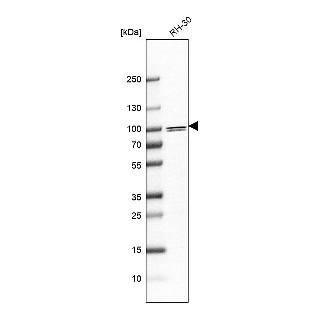 Atlas Antibodies Anti-PARP9 Antibody