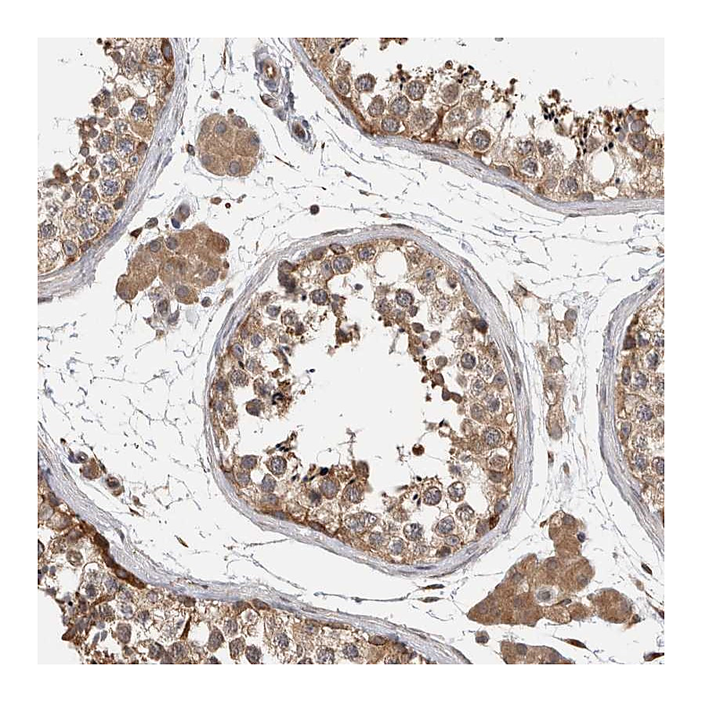 Atlas Antibodies Anti-PARP6 Antibody