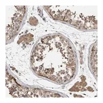 Atlas Antibodies Anti-PARP6 Antibody