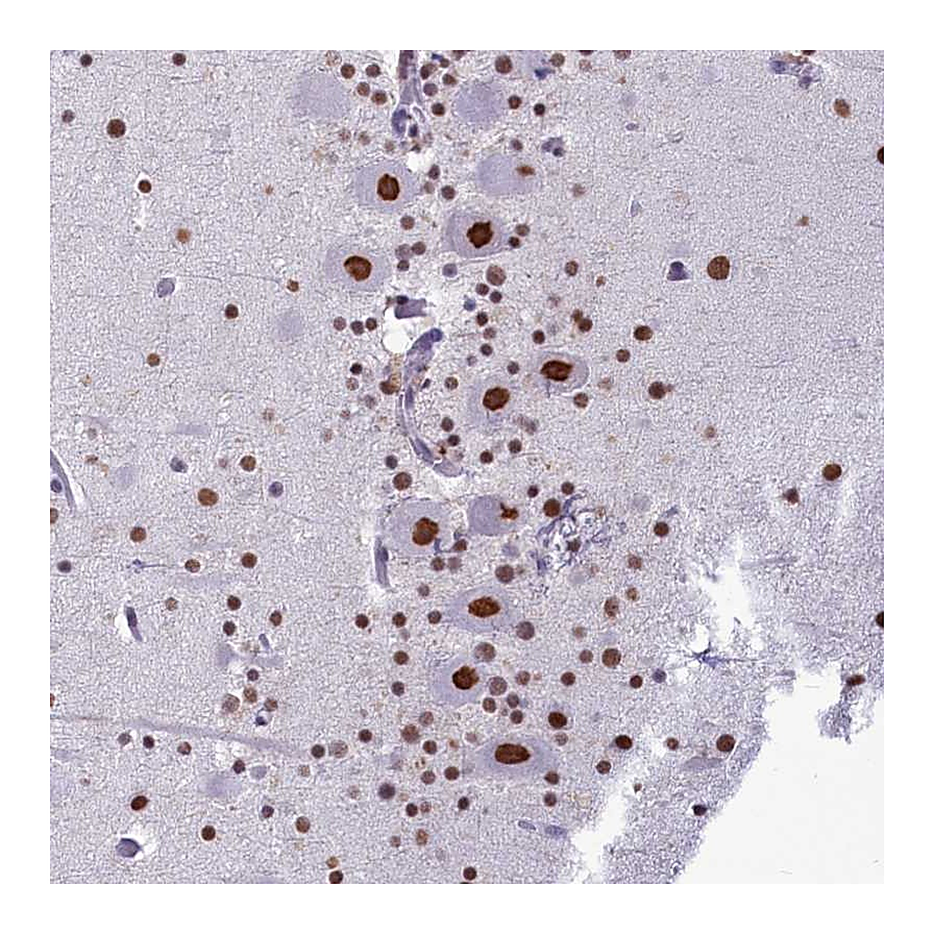 Atlas Antibodies Anti-PARPBP Antibody