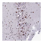 Atlas Antibodies Anti-PARPBP Antibody
