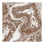 Atlas Antibodies Anti-PARS2 Antibody