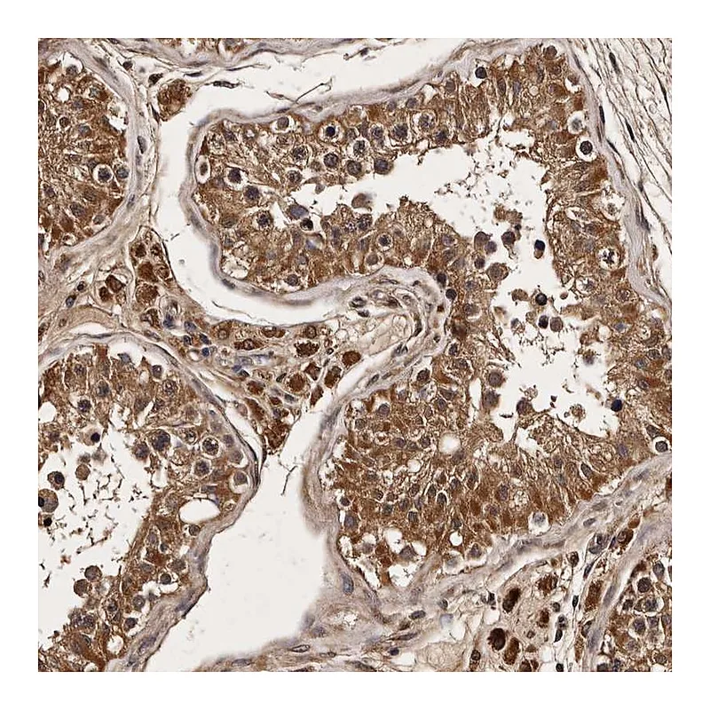 Atlas Antibodies Anti-PARS2 Antibody
