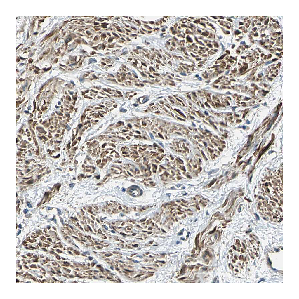 Atlas Antibodies Anti-PARVA Antibody