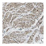Atlas Antibodies Anti-PARVA Antibody