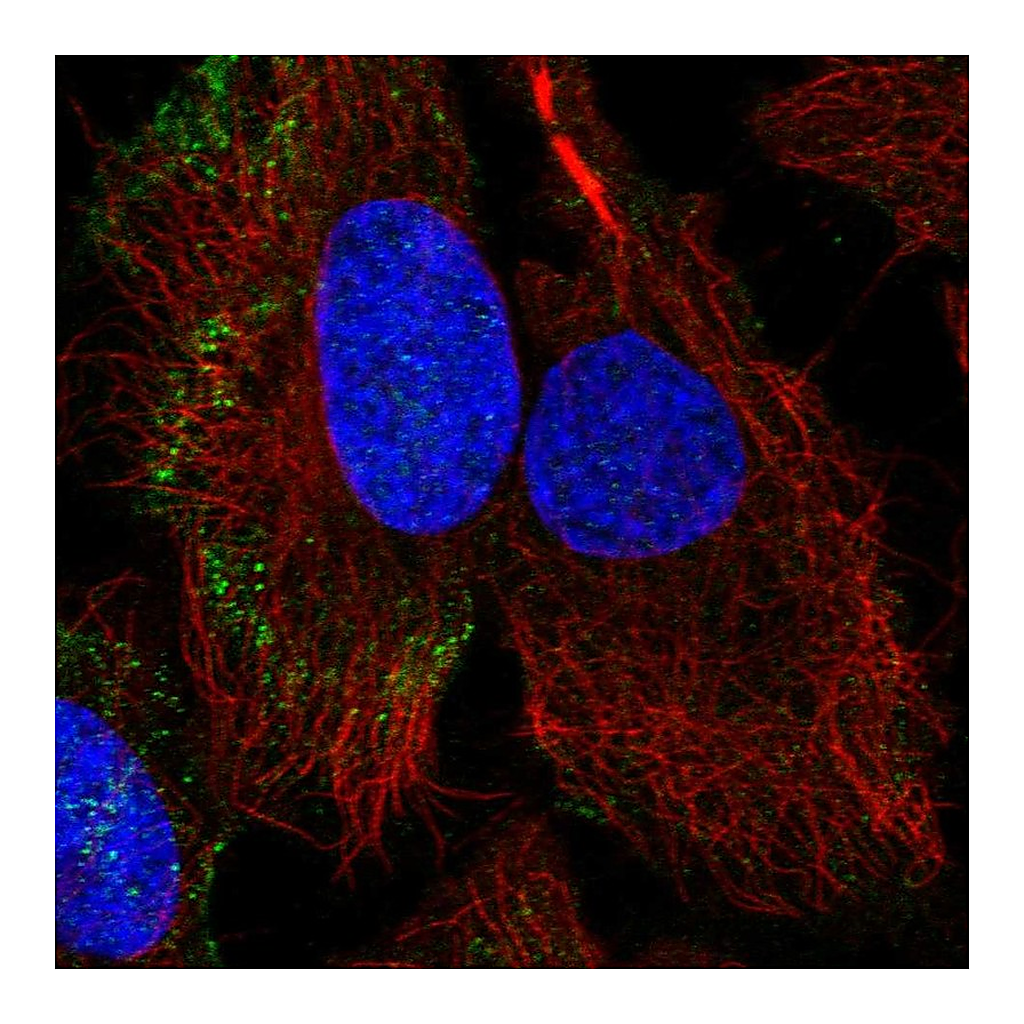 Atlas Antibodies Anti-PARVB Antibody