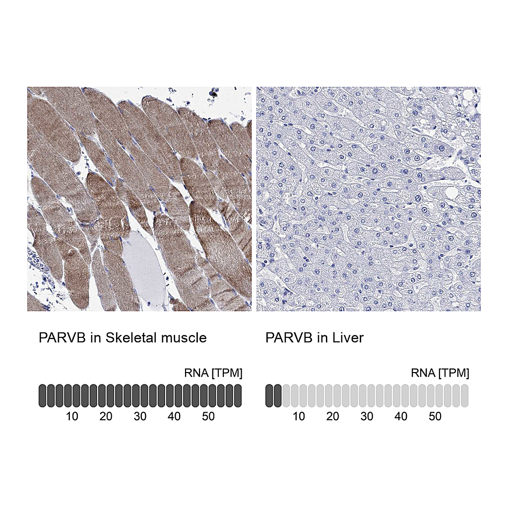 Atlas Antibodies Anti-PARVB Antibody