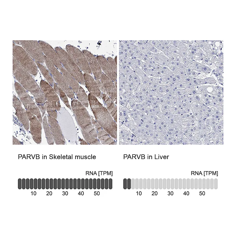 Atlas Antibodies Anti-PARVB Antibody