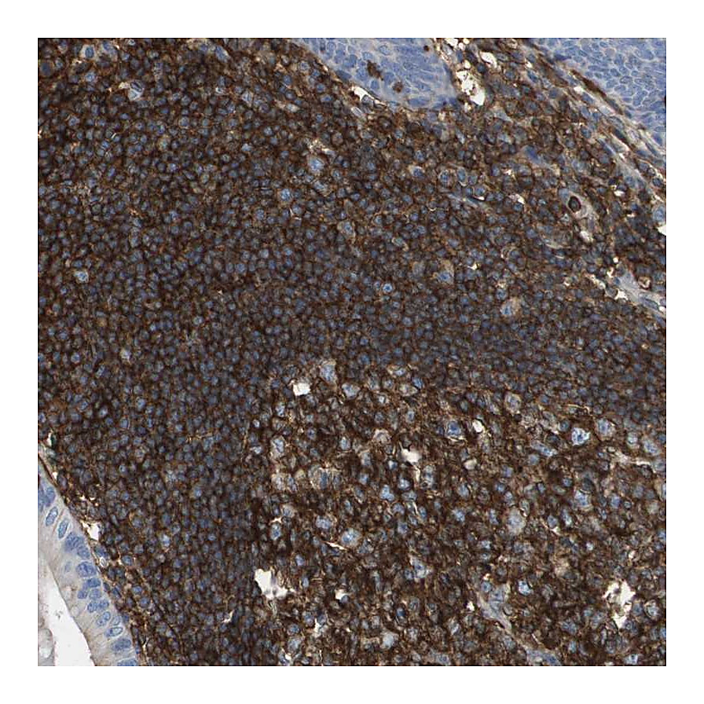 Atlas Antibodies Anti-PASK Antibody