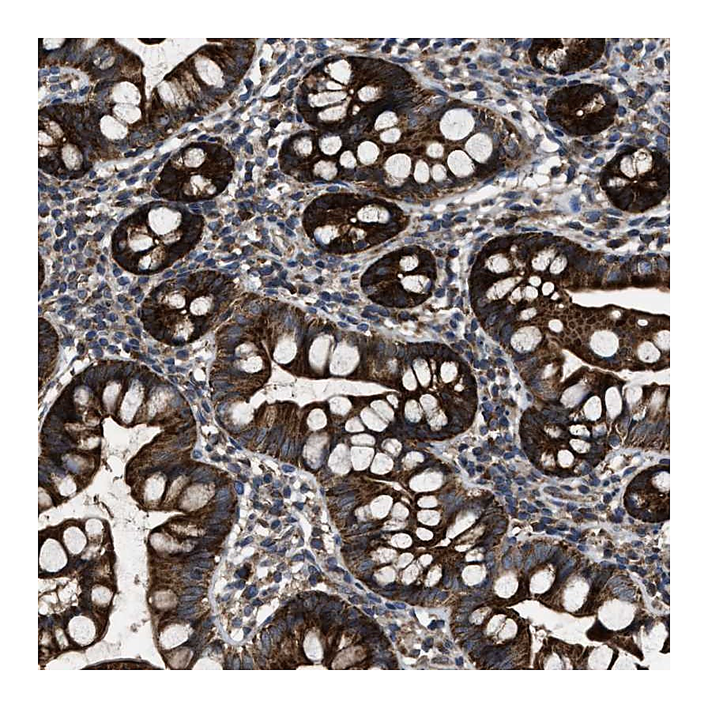 Atlas Antibodies Anti-PASK Antibody
