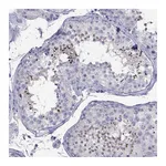 Atlas Antibodies Anti-PATE1 Antibody