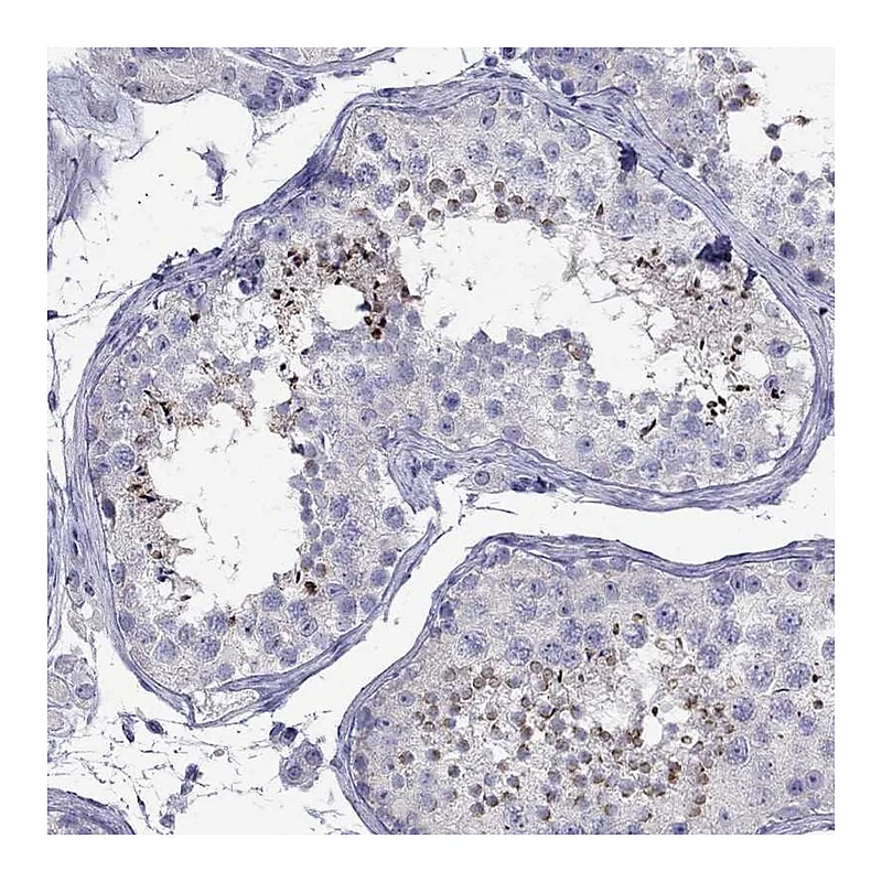 Atlas Antibodies Anti-PATE1 Antibody